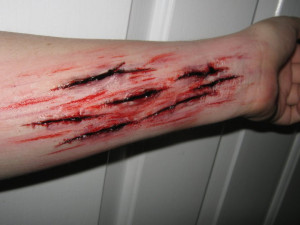 Arm Cuts