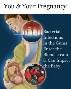 DENTAL HEALTH & PREGNANCY | DENTALORG.COM