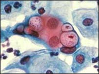 chlamydia bacteria Images and Graphics