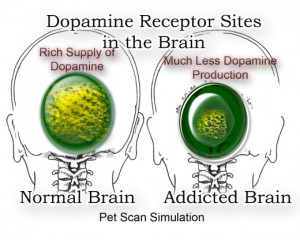 Pet Scan Simulation Reveals Dopamine Receptor Sites in the Brain