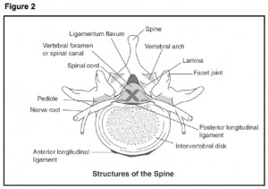 who gets spinal stenosis what structures of the spine are involved ...