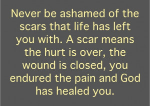 Praise God we don't have to hide scars