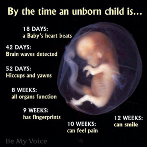 unborn child.God, Babies Children, Pro Life, Baby Boards, Unborn Child ...