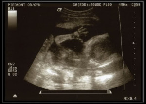Ultrasound Waving 22807 Image