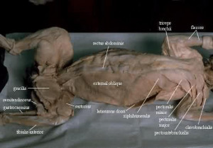 cat muscle superficial dissection diagram
