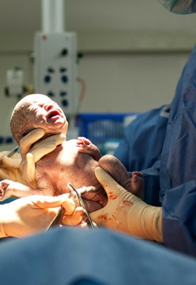... Know About Giving Birthby Cesarean Section… a good review of things