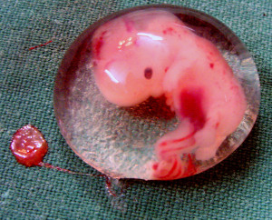 Menschlicher Embryo in der 5. Woche p.c. (7. SSW ).