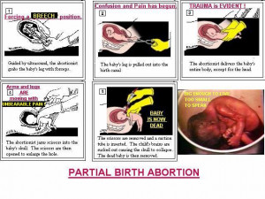... further facts and key info on partial-birth abortion, please go to