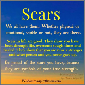 Scars, We all have them. Whether physical or emotional, visible