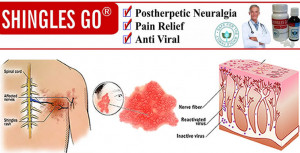 Cure Shingles Pains Naturally