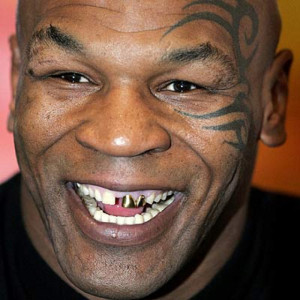 ... ・タイソンさん（Mike Tyson）の前歯の画像です