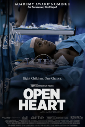 Open Heart