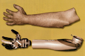 How science is helping for a better future ? Lending a hand and a leg ...