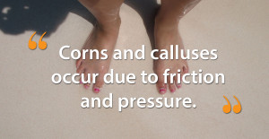 Corns and Calluses: Don’t let them Take Control