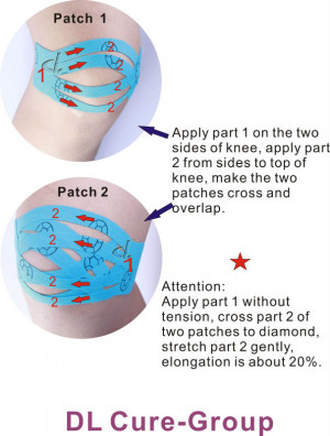 treat anterior knee pain/knee ligament diagram/common knee problems