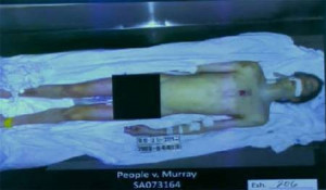 Michael Jackson autopsy photo - Warning: Graphic (Robyn Beck-Pool ...