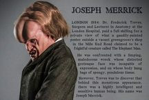 Joseph Merrick Skeleton