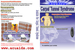 Carpal Tunnel Acupuncture Points Chart