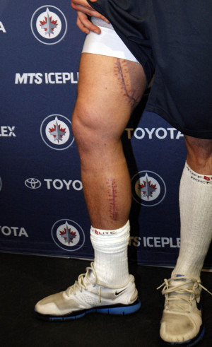 Miracle On Ice Quotes Updated: a 'miracle' redmond