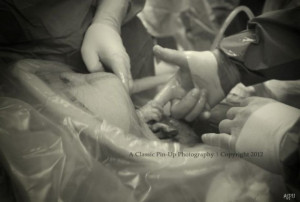 ... Phoenix Baby Holding Doctors Finger During Cesarean Section Goes Viral