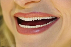 ... Smile, White Teeth, Dental Crowns, Dental Care, Cosmetics Dentistry