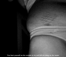 cutting-quotes-scars-self-harm-761629.jpg
