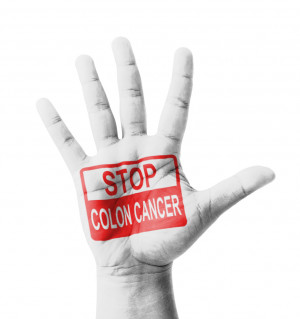 Reasons to Schedule Your Colon Cancer Screening Today