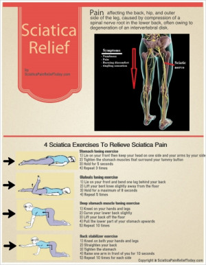 Sciatica Exercises To Relieve Sciatica Pain Infographic