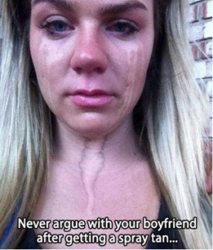 10 problems only people with Irish skin must face