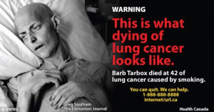 ... lung cancer in one of the new anti-smoking campaign images in Canada