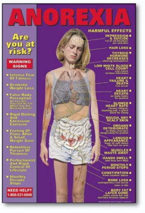 ... anorexia and other eating disorders anorexia is a complex condition