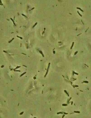 Pond Water Under Microscope