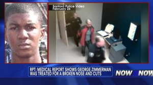 George Zimmerman Broken Nose Pictures