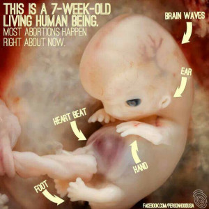 Although above was a late term abortion, often ones done early are ...