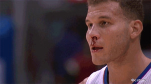 Tags: Blake Griffin Blake Griffin Bleeding GIF Los Angeles Clippers ...