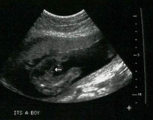 second trimester week 19 ultrasound 19 weeks it s a boy