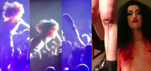 ... Adore Delano’s stage dive fail in Vancouver, Canada during their