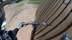 ... my hand open to reveal the screws. Skip it if you have a weak stomach