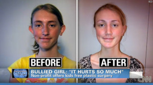 Is plastic surgery a solution to bullying? | HLNtv.com