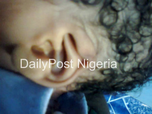Woman gives birth to baby with strange Islamic sign shaped ears in ...