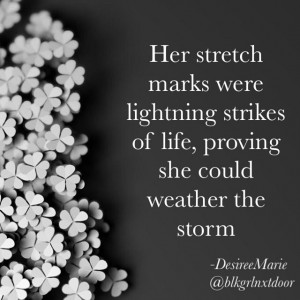 Chrissy Teigen Embraces Her Stretch Marks, Continues To Prove She’s ...