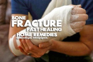 HOME REMEDIES FOR BONE FRACTURE - HEAL BROKEN BONE FASTER NATURALLY