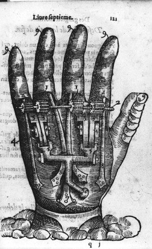 16th Century Prosthetics from Ambroise Paré