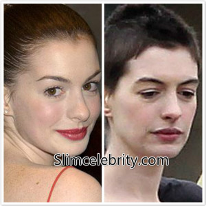 Anne Hathaway Before and After