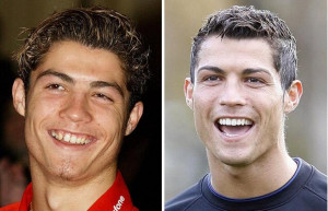 Cristiano-Ronaldo-had-a-gaps-between-teeth-2-cristiano-ronaldo ...