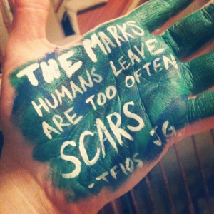 The marks humans leave are too often scars