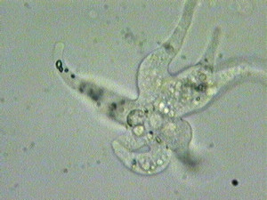 Freshwater Microscopic Anisms