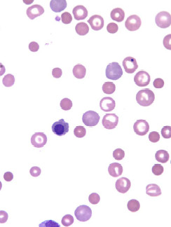Abnormal Red Blood Cell Morphology Canine