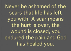 ... are signs of wounds closed, pain endured, & being healed from God