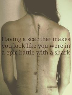 Mine doesn't but its still a pretty big scar.- that made me laugh but ...